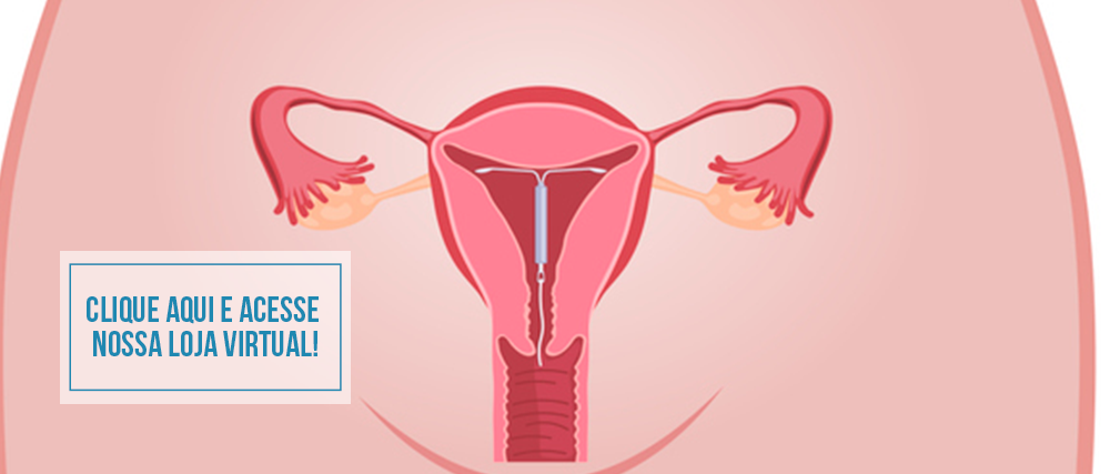 diu, mulher, contracepção